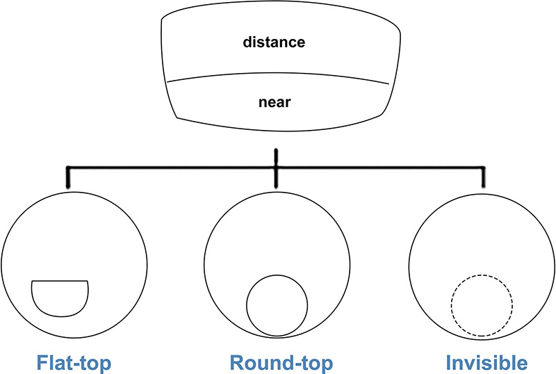 What can you choose in Bifocal lens